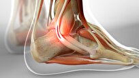 Scientists Develop New Treatment for Tendon-Bone Injuries