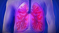 Nanoparticles Repair Lung Tissue Damaged From Flu or COVID-19