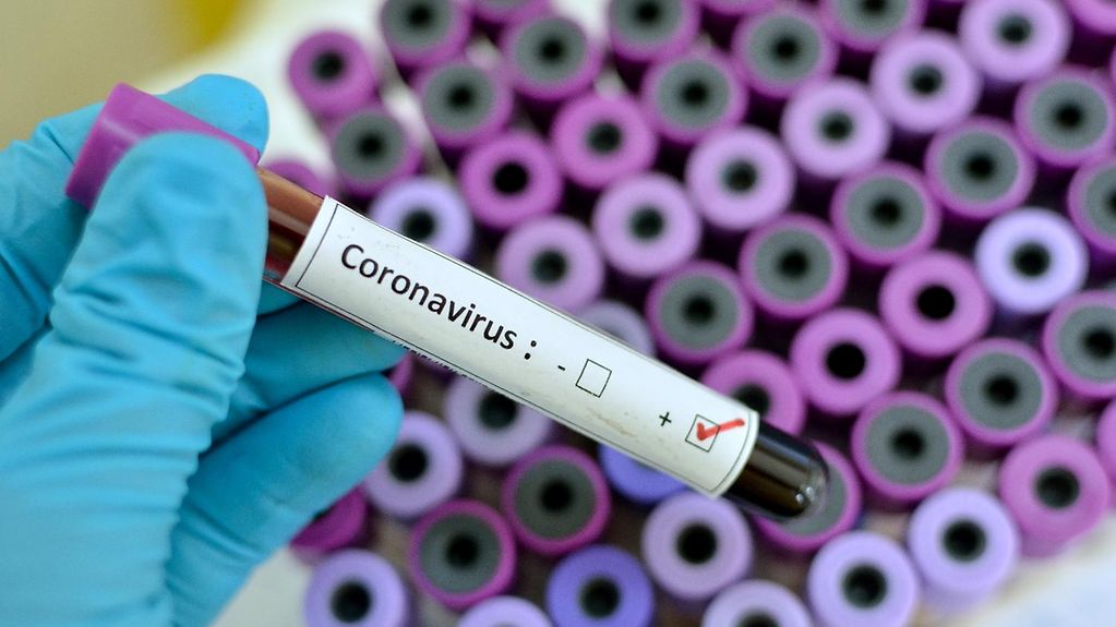2020-02-24-coronavirus-farsi.jpg