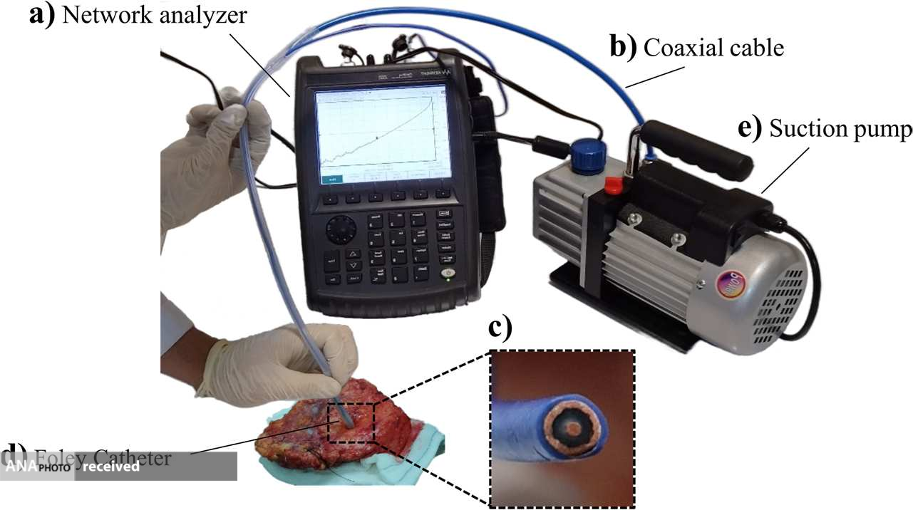 طريقة جديدة لتشخيص سرطان الثدي