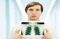 علماء روس يطورون عدسة نانوية قد تُحدث ثورة في التصوير الطبي