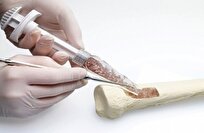 علماء يطوّرون مادة حيوية قابلة للتحلل لتسريع ترميم العظام