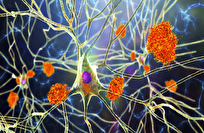 النبات-"المعجزة"-أمل-جديد-في-مواجهة-ألزهايمر