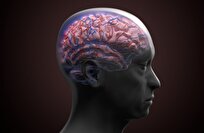 ذكاء اصطناعي يُحدث ثورة في تشخيص الخرف بدقة غير مسبوقة