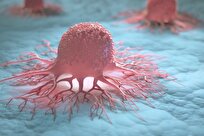 الذكاء-الاصطناعي-في-خدمة-الطب-إنجاز-طبي-إيراني-جديد-يبهر-العالم