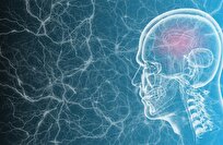 دراسة تربط بين تلوث الهواء وزيادة خطر نزيف الدماغ