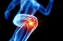 الألياف البلاستيكية الدقيقة وتأثيراتها على سلامة العظام