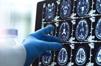 تقنية الذكريات الاصطناعية تحاكي الماضي لتعزيز علاج مرضى الخرف والزهايمر