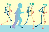 AI-Based Pose-Mapping Technique Could Remotely Evaluate Patients with Cerebral Palsy