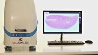 Iran-Made AI-Based Slide Scanner Facilitates Imaging of Pathology Samples