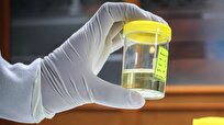 New Sensor Can Diagnose Cancer Using Urine