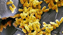 Pseudomonas Aeruginosa Bacteria Produce Molecule Paralyzing Immune System Cells