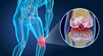 Iranian Scientists Find New Way for Differentiation of Mesenchymal Stem Cells into Cartilage Cells