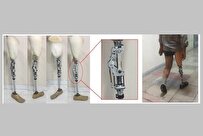 Iranian Researchers Produce Passive Artificial Knee for Amputees