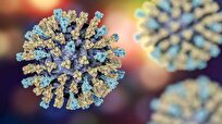 Researchers Map How Measles Virus Spreads in Human Brain
