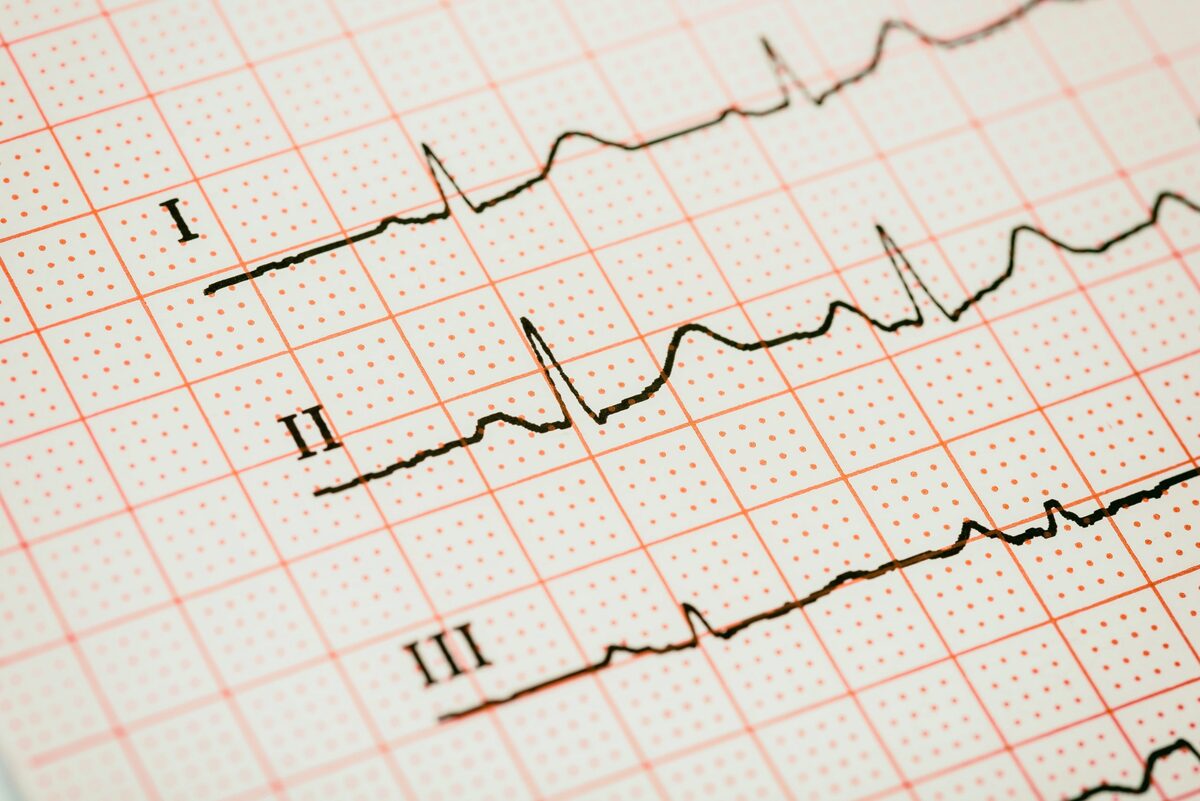 Iranian Company Domestically Produces 12-Lead Electrocardiogram