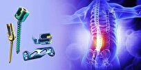 Iranian Knowledge-Based Firm Makes Spinal Implants