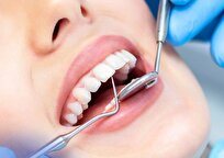 Iranian Scientists Use Nanotechnology to Increase Strength of Dental Crowns