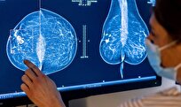 Aussie Scientists Discover Biomarkers of Hard-to-Diagnose Breast Tumor