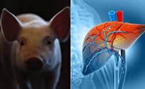 Researchers Transplant Gene-Edited Pig Liver into Living Human Patient