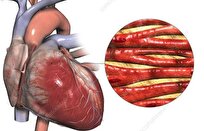 Can Heart Damage Be Reversed?