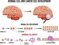 Putting Lid on Excess Cholesterol to Halt Bladder Cancer Cell Growth