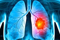 Iranian Scientists Present New Method for Drug Delivery to Lungs