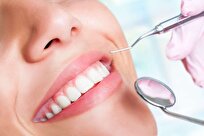 Iranian Scientists Produce Bleaching Gel for Dentistry