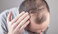 Popular Hair Loss Drug Linked to Suicide