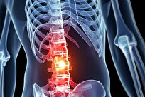 Iranian Scientists Gain New Achievement in Tissue Engineering, Treatment of Spinal Cord Injuries