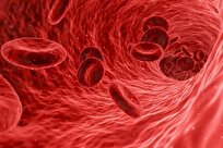 Iran-Made Nano Supplement Treats Iron Deficiency Anemia in Short Period