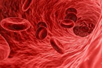 Iran-Made Nano Supplement Treats Iron Deficiency Anemia in Short Period