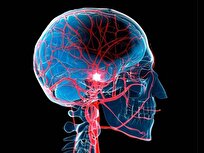 This Natural Compound Could Protect Brain against Stroke