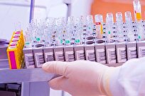 Iranian Company Produces Ultrasonic Homogenizer 