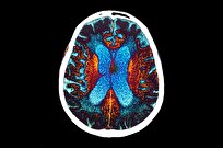 Scientists Discover Natural Compounds That Clear Alzheimer’s Proteins