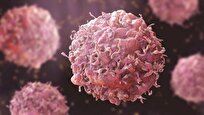 Study Finds One Workout Can Cut Cancer Cell Growth by 30%