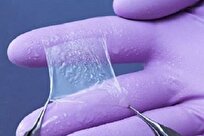 Production of First Dry Biological Dressing from Amniotic Membrane in Iran