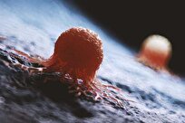 New Diet Slows Growth of Deadliest Brain Tumors in Mice