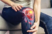 Breakthrough ‘Artificial Cartilage’ Could Transform Arthritis Treatment