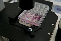Iran’s Royan Research Institute Using Umbilical Cord Stem Cells to Treat Arthritis
