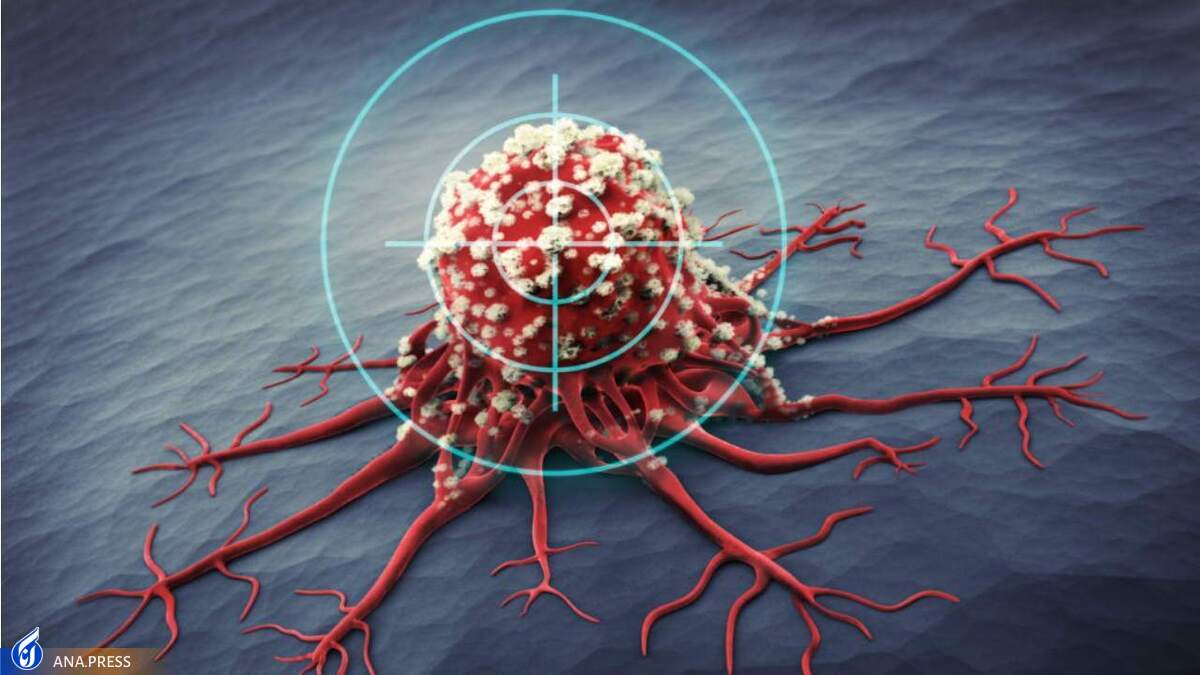 آنزیم خاص انسانی برای درمان سرطان کشف شد