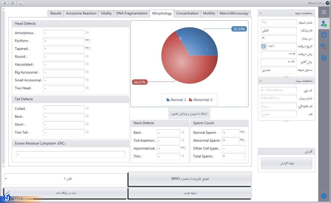 طراحی و ساخت دستگاه آنالیز اسپرم با نتایج دقیق و تکرارپذیر