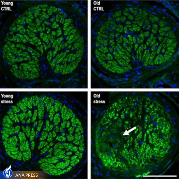 استرس مکرر می تواند پیری چشم را تسریع کند