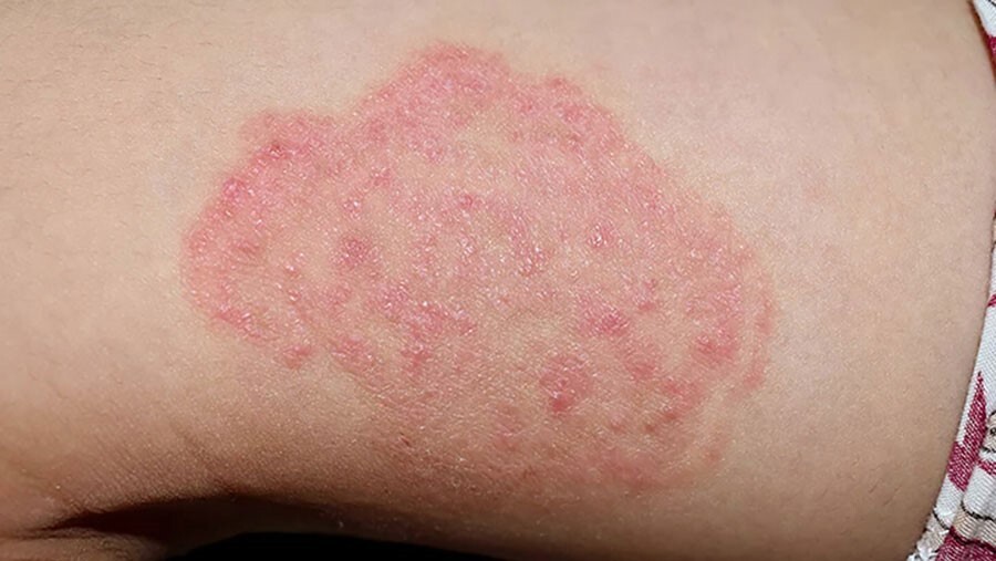 مصرف ال آرژنین بدون ورزش: آنچه افراد غیرورزشکار باید بدانند