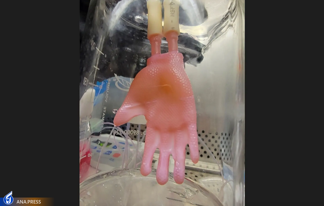 پوست سهبعدی آزمایشگاهی که مانند لباس پوشیده میشود پوست سهبعدی آزمایشگاهی که مانند لباس پوشیده میشود