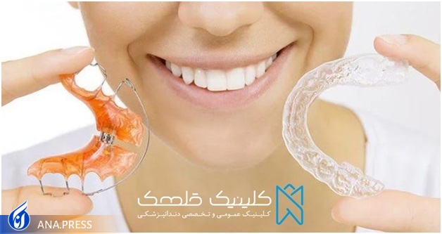 آشنایی با تفاوت کامپوزیت دندان و لمینت دندان