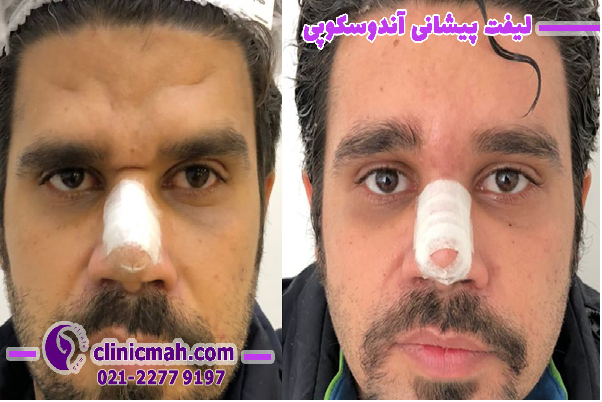 بررسی برخی عمل های زیبایی در کلینیک ماه
