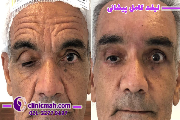 بررسی برخی عمل های زیبایی در کلینیک ماه