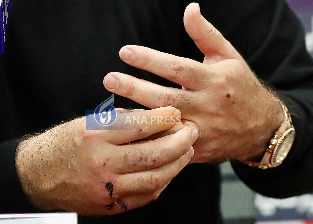 ساپینتو ساپینتو