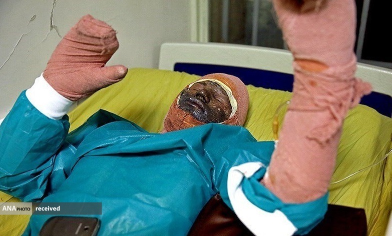 یک خودرو در تهران دچار حریق  شد و 17 نفر بر اثر شدت جراحات جان باختند